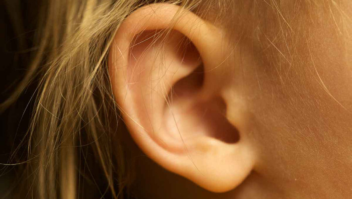 Orejas