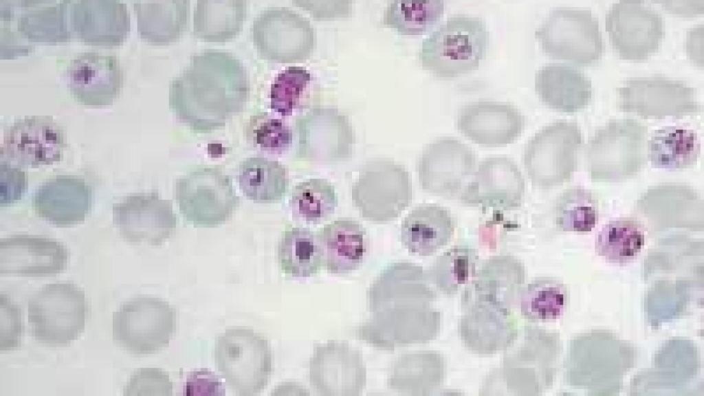 Image: Cerco a la Malaria