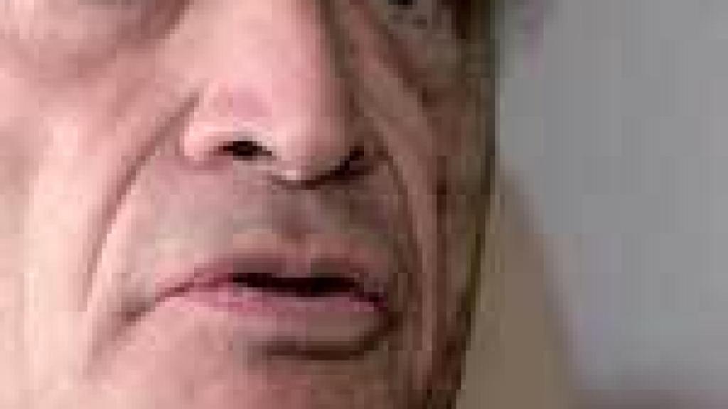 Image: Oído atento a los pájaros