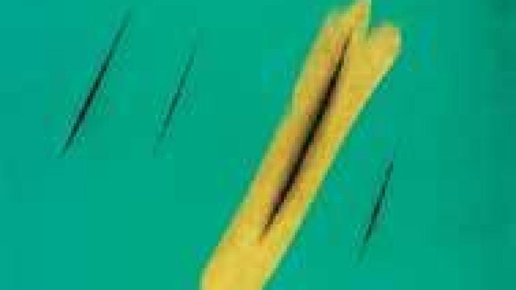 Image: Lucio Fontana, cortes de silencio