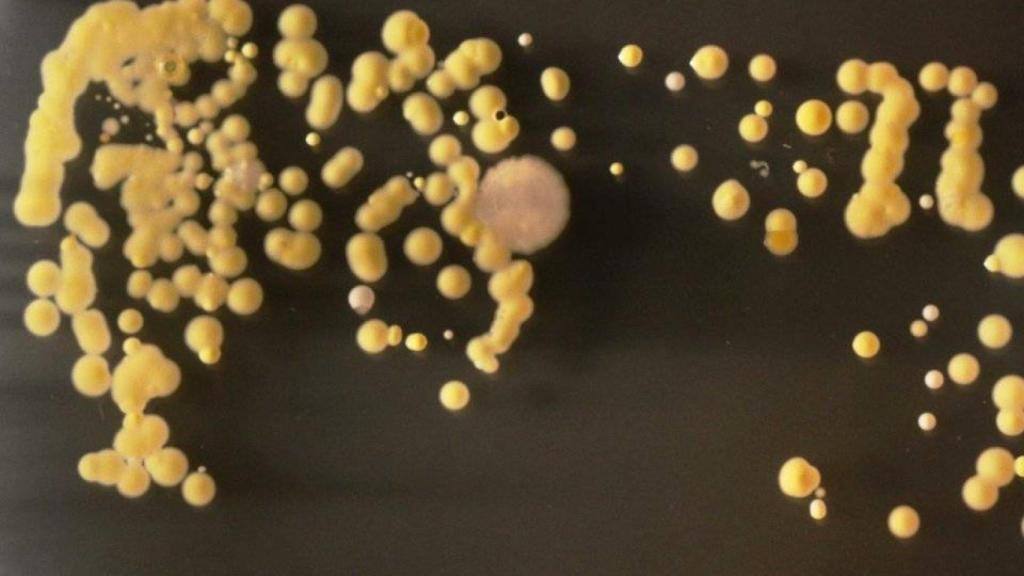 Bacterias-smartphone-2