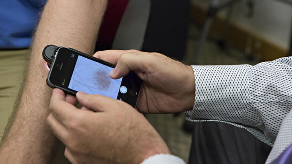 iPhone app cancer piel