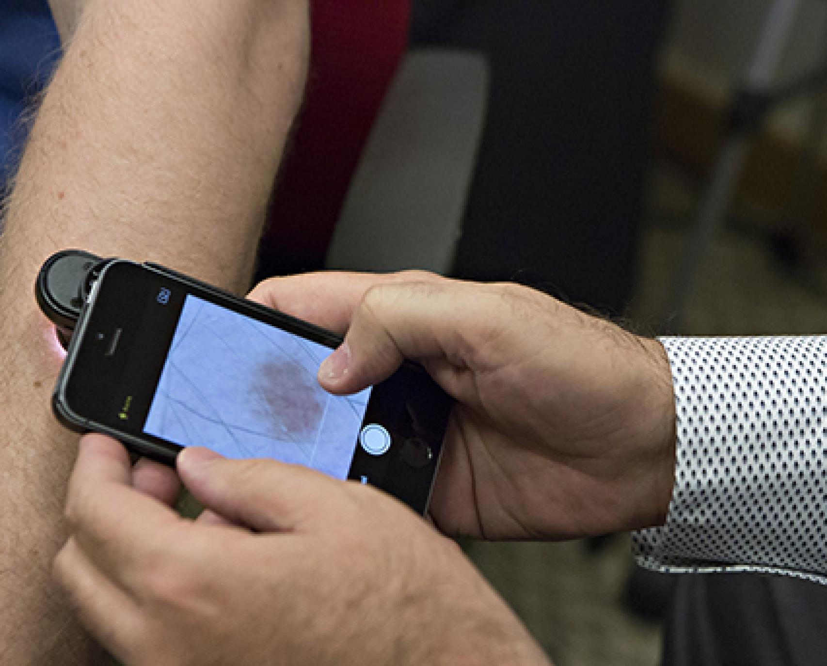 Examen de piel a través del móvil.