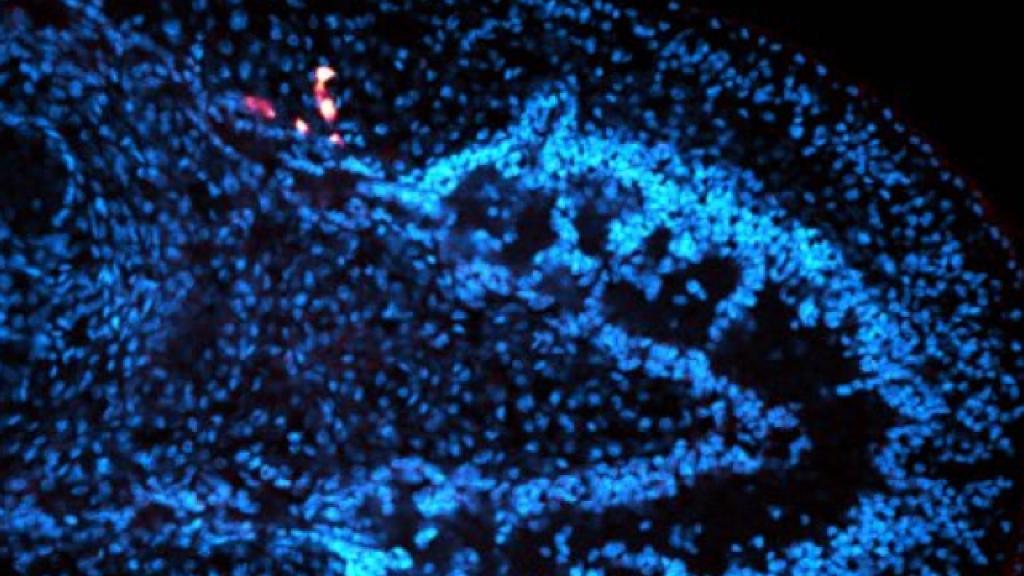 celulas-madre-gusano