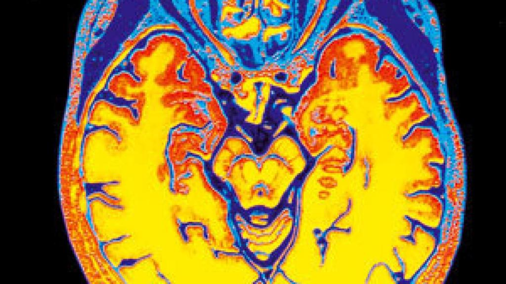 Image: Y el cerebro creó al hombre