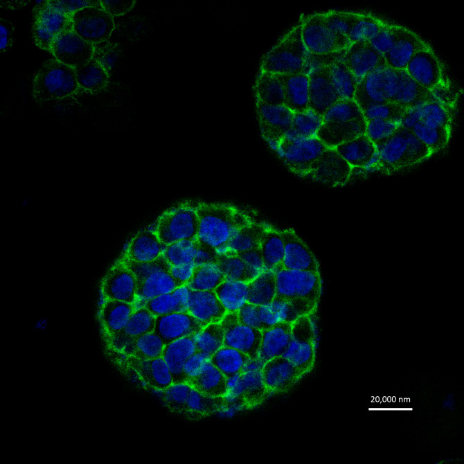 celulas_tumorales_3d