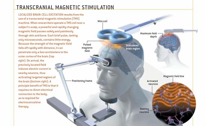 estimulacion_transcraneal