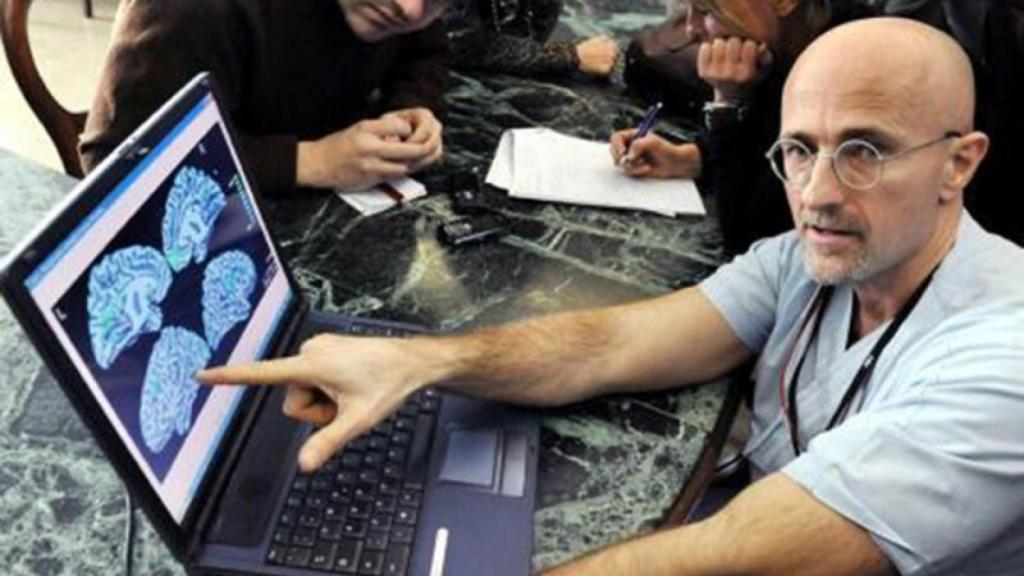 trasplante de cabeza 1