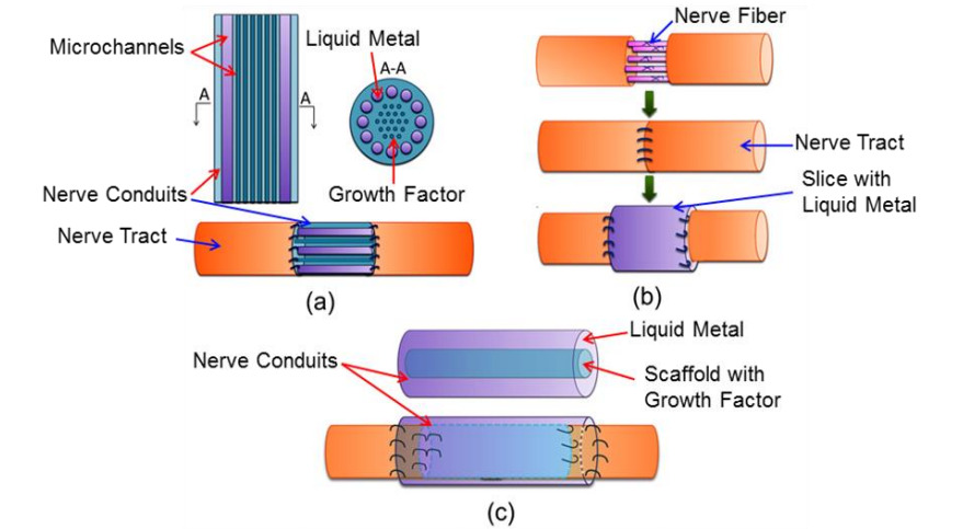 nervios_metal_liquido