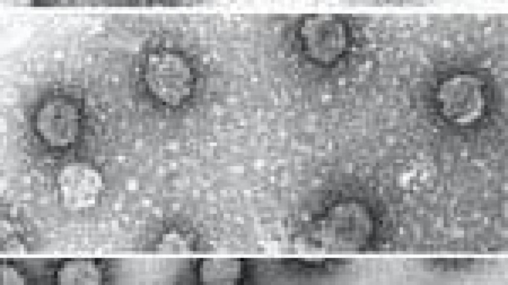 Image: De la gripe al SARS