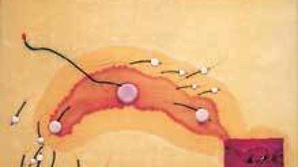 Image: Evru o la reencarnación