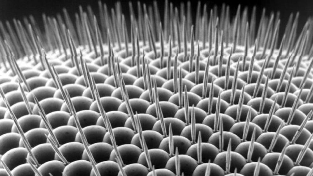 751px-Drosophilidae_compound_eye_-thumb-640xauto-2802