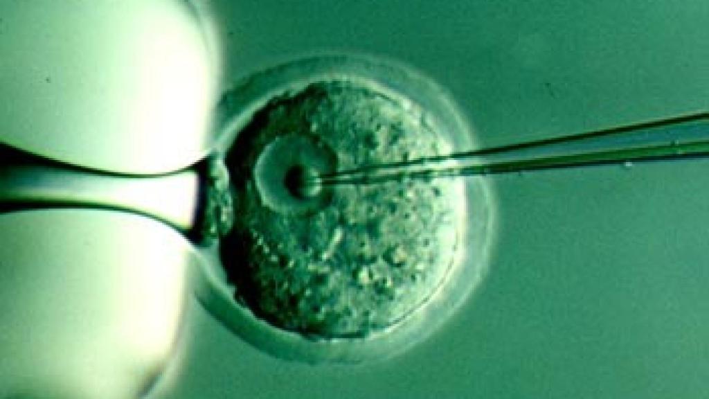 Clonación genética.