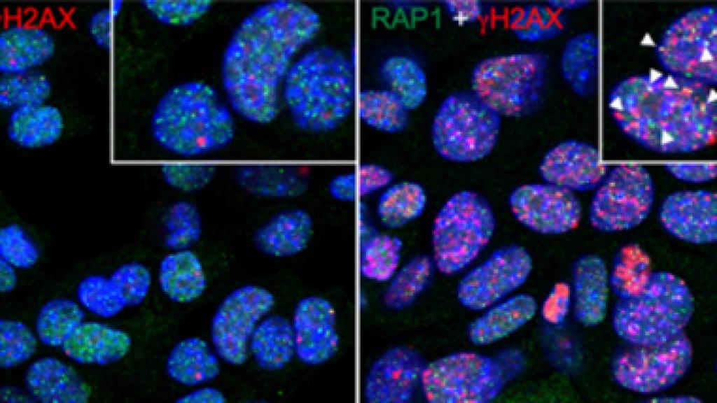 Image: El cáncer deja de ser inmortal