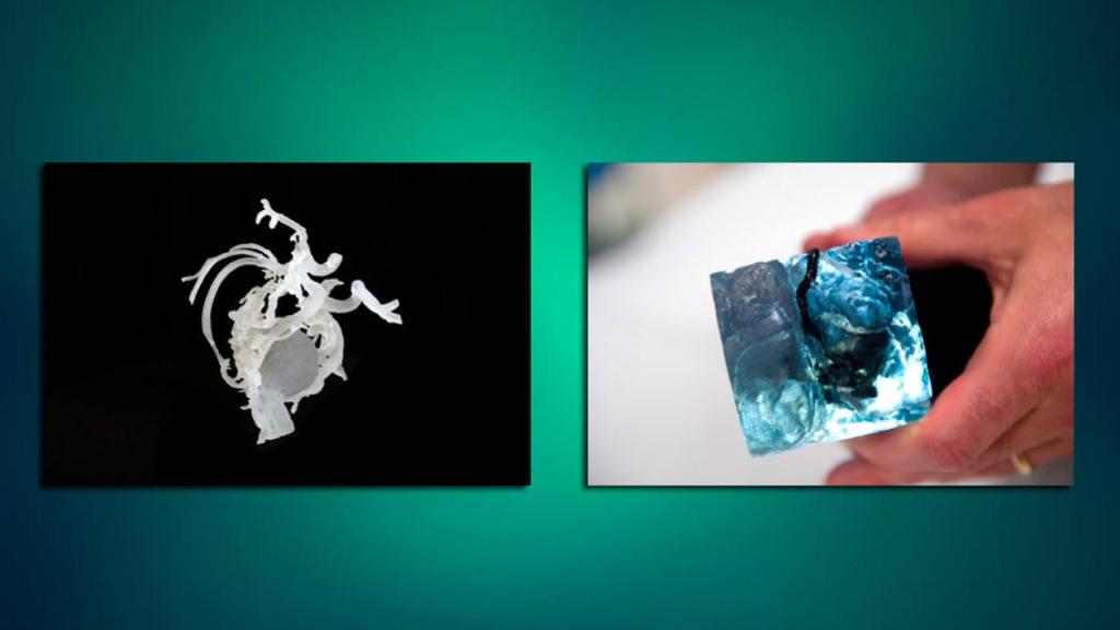 impresion-3d-cerebral