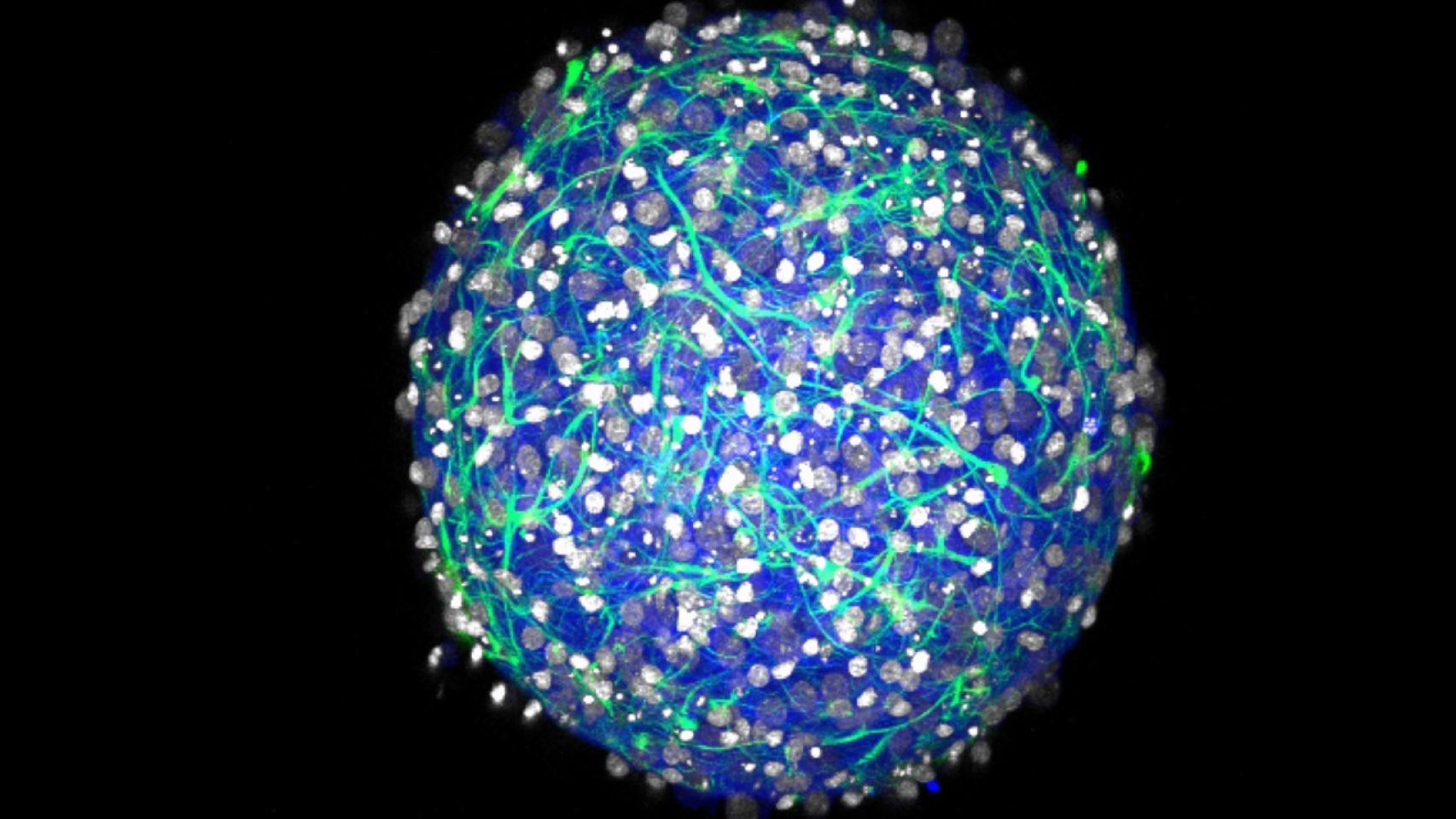 La esfera en 3D persigue superar los modelos bidimensionales.