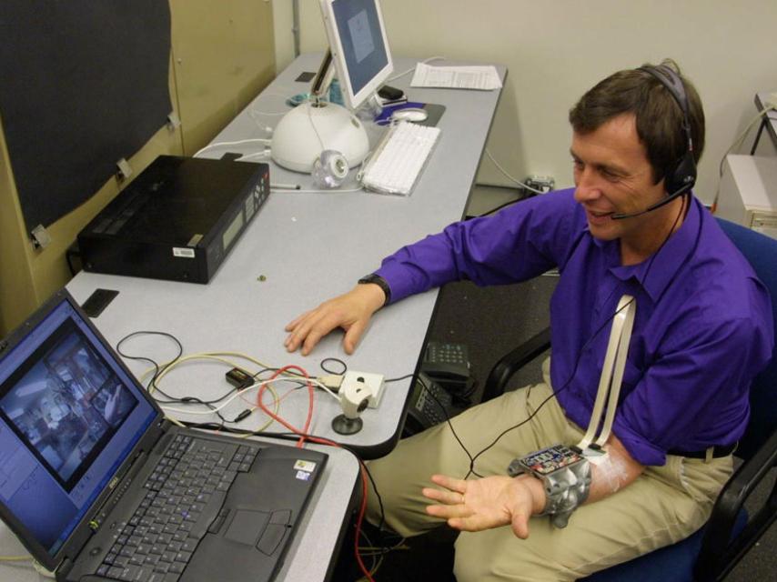 El profesor Kevin Warwick lleva un implante en el sistema nervioso.