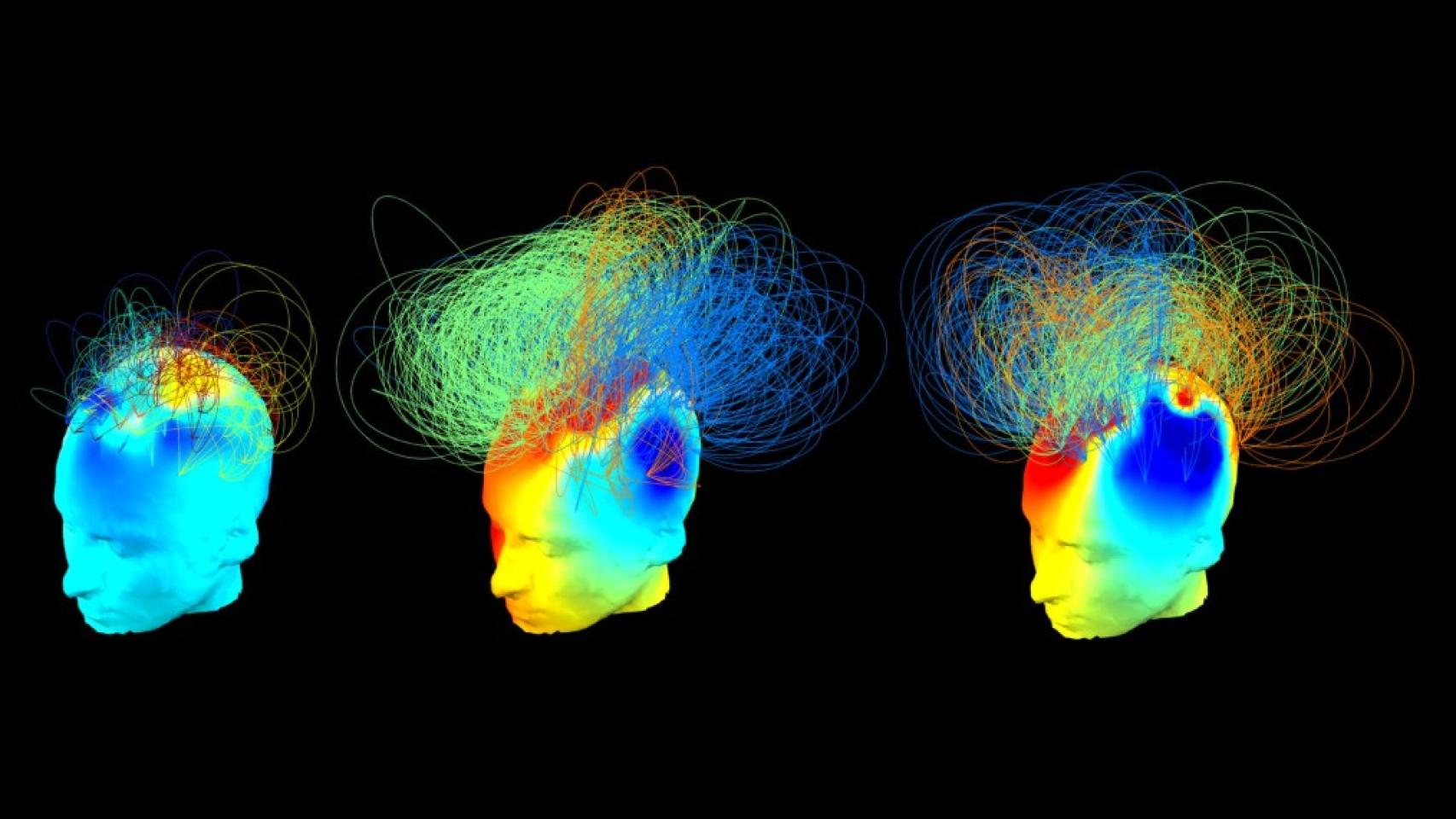Redes neuronales de un paciente vegetativo consciente (C) y de uno sano (D).