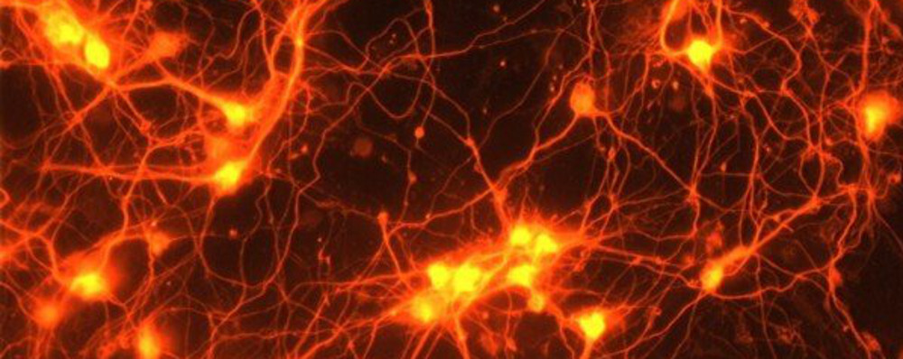 reparardañoscerebrales3