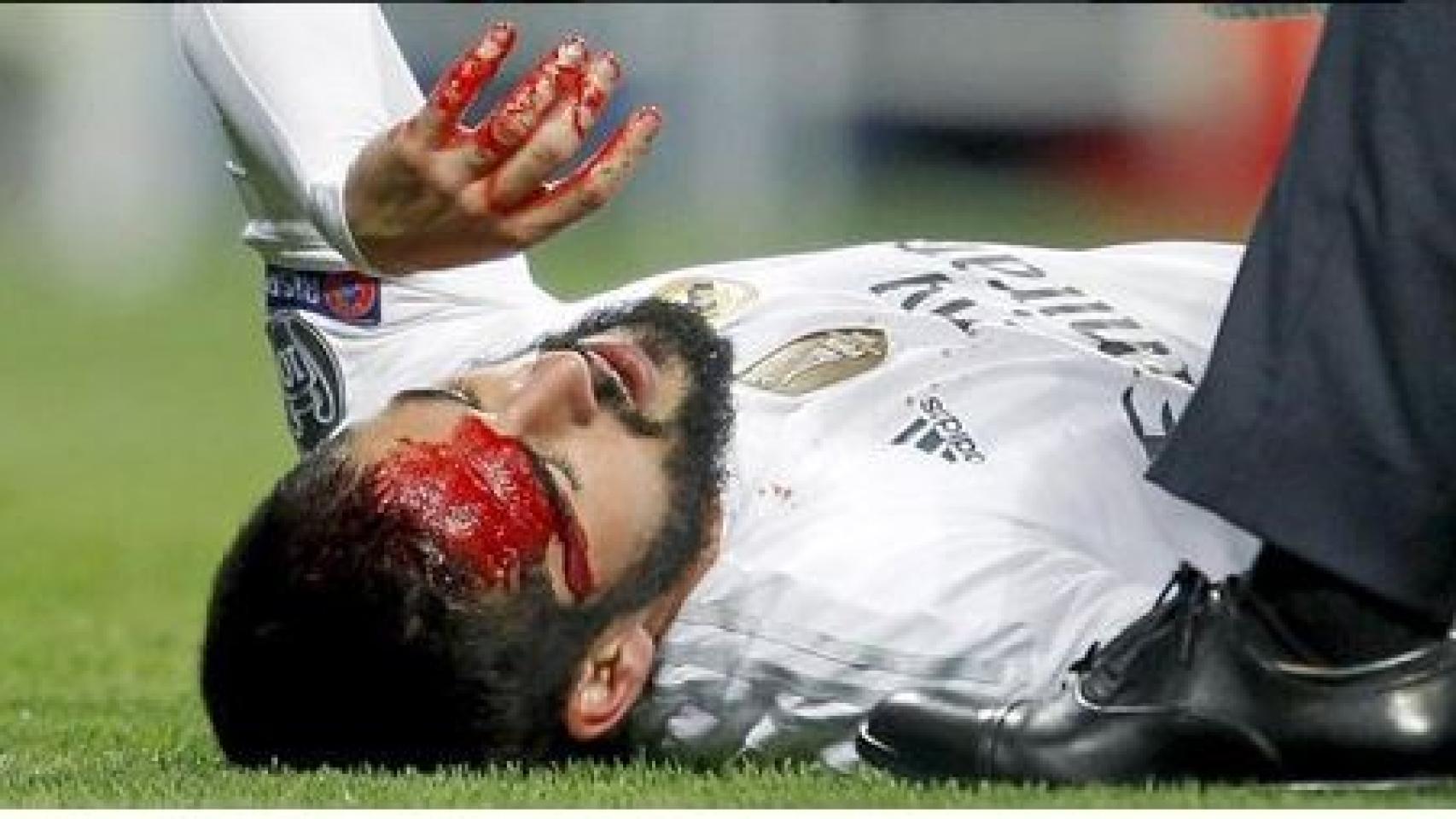 Isco, tras el choque con Aurier.