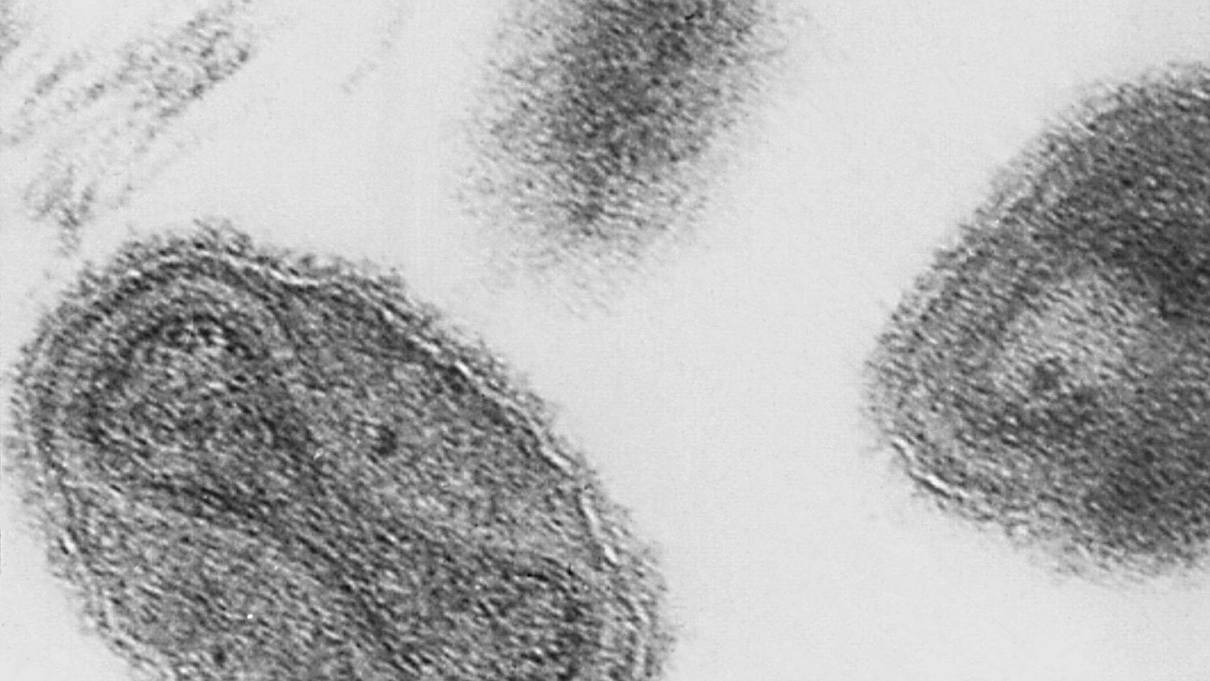 Micrografía electronica del virus de la viruela.