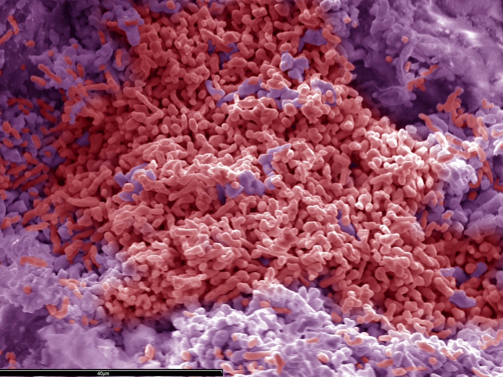 Bacterias extremófilas al microscopio.