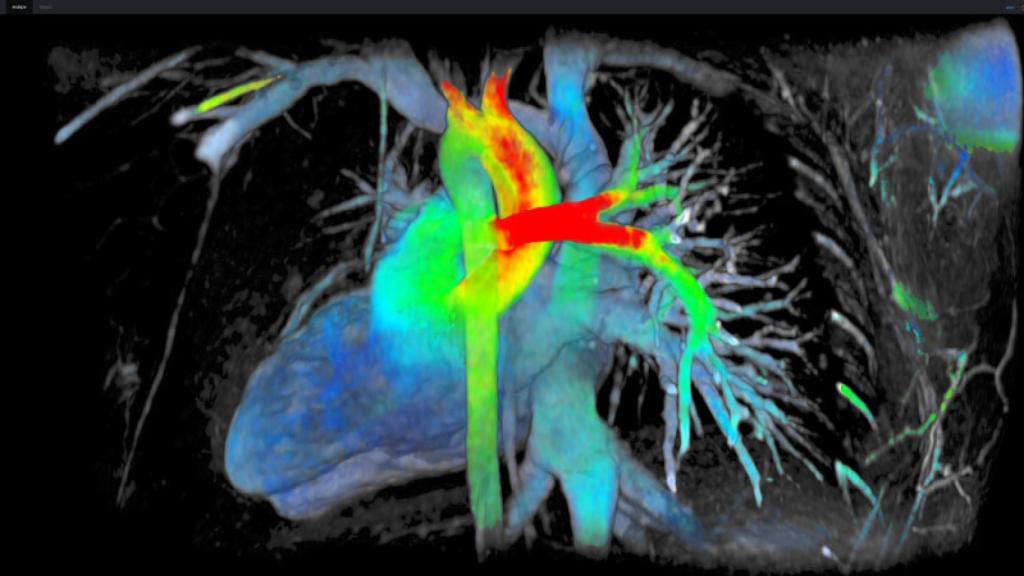 resonanciamagnéticade7dimensiones1