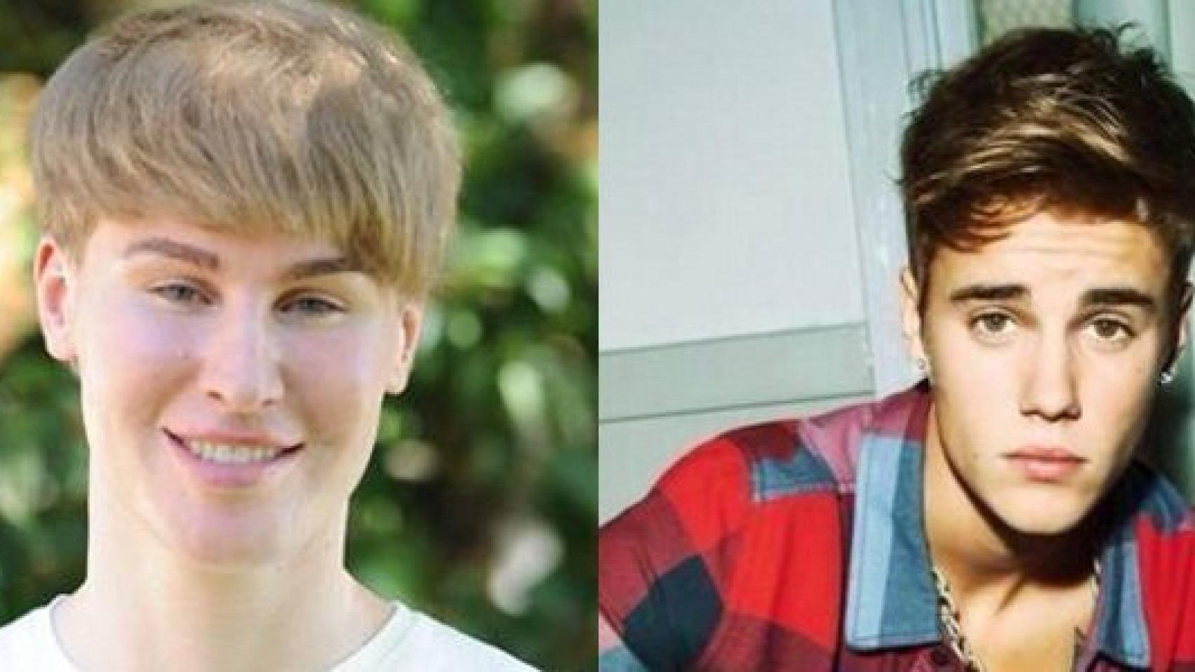El fan de Justin Bieber que se operó para parecerse a su ídolo