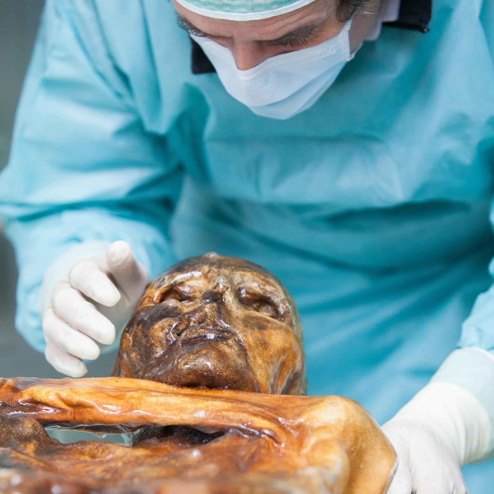 Investigador trabaja con la momia hallada en los Alpes.