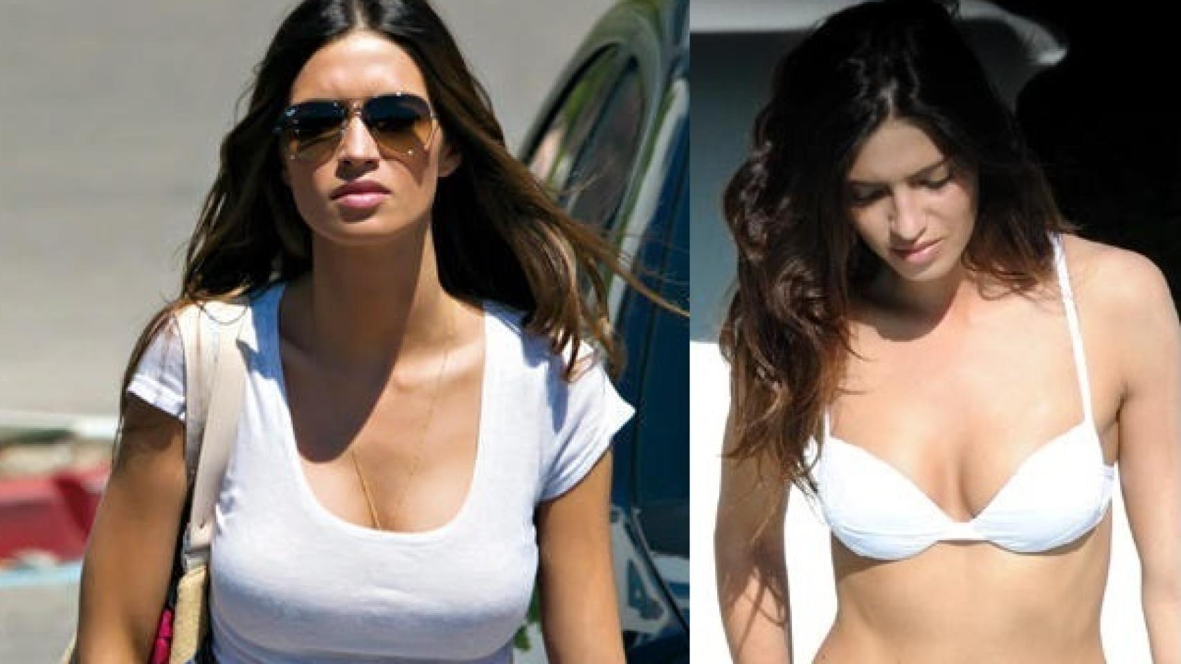 Sara carbonero después y antes de su intervención