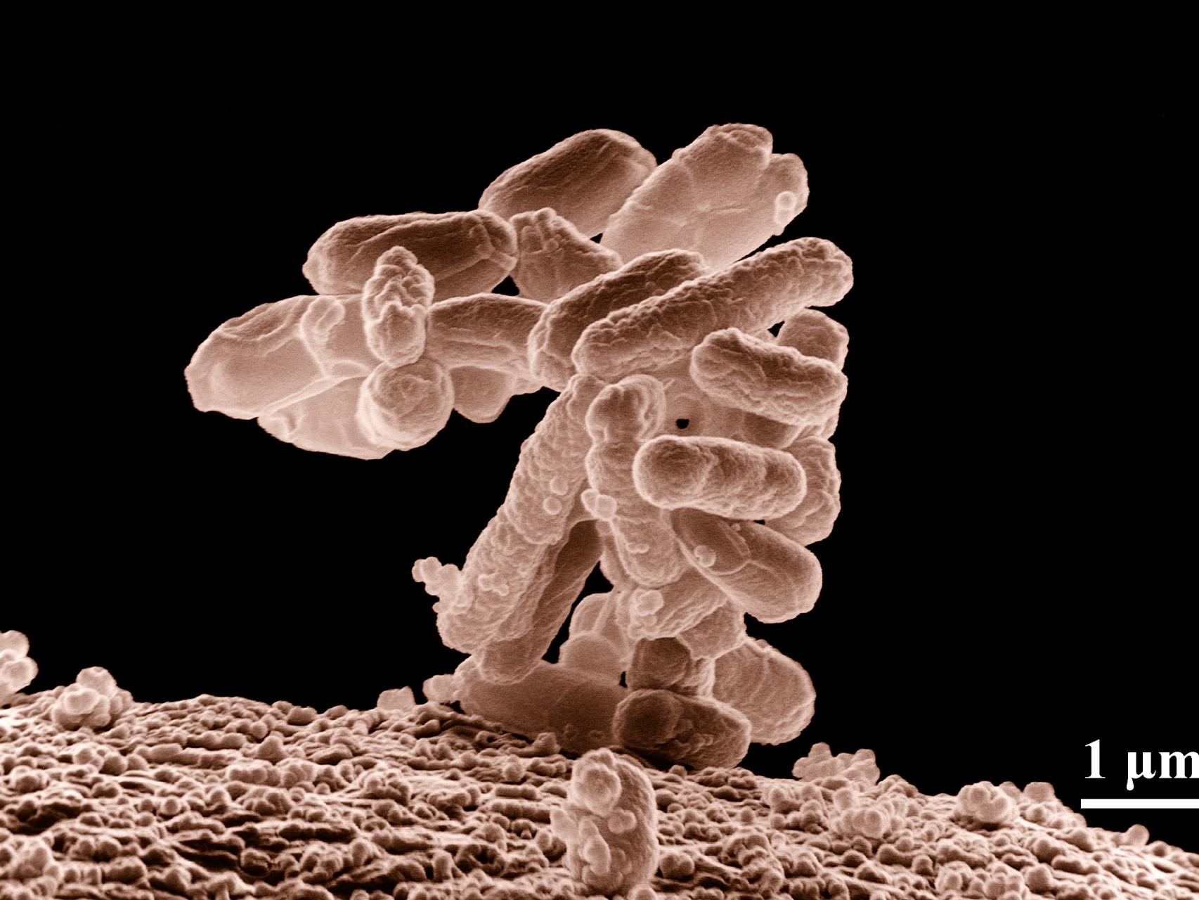 Imagen aumentada de E-Coli