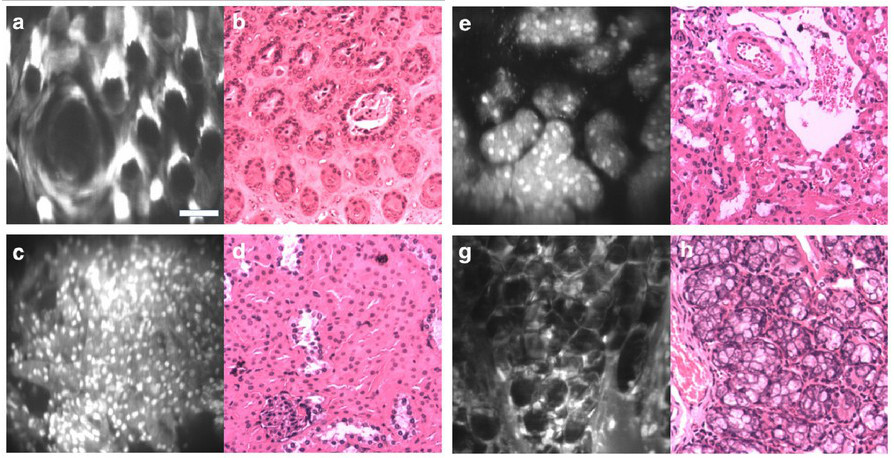 imagenes microscopio de mano