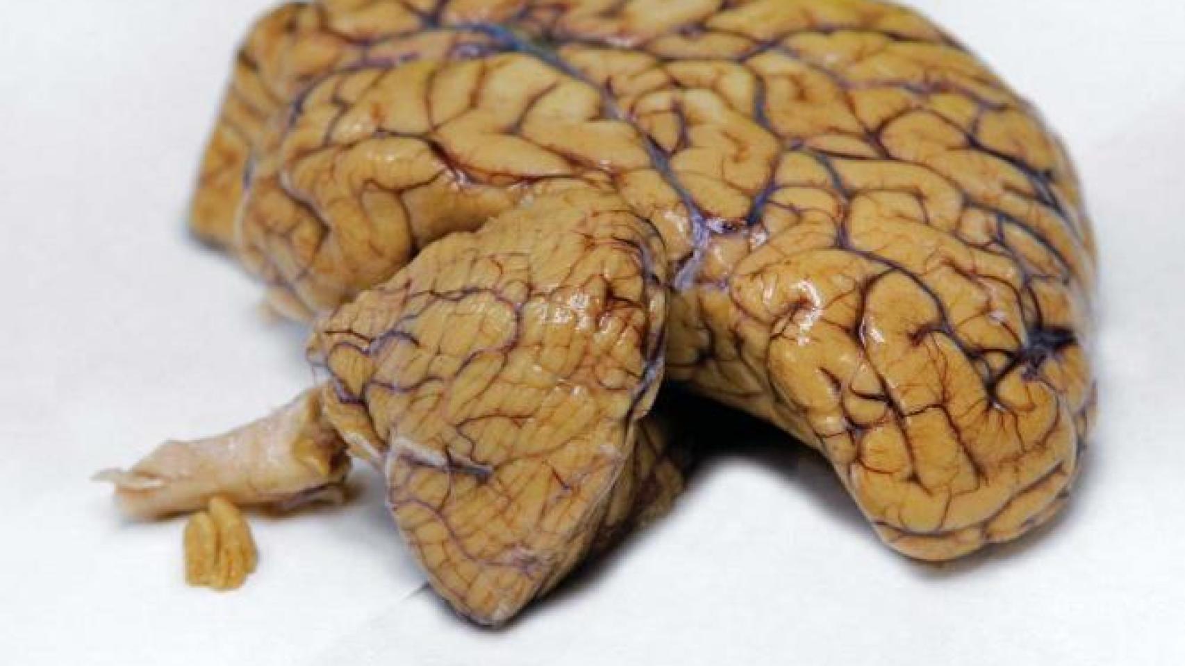 Imagen de un cerebro.