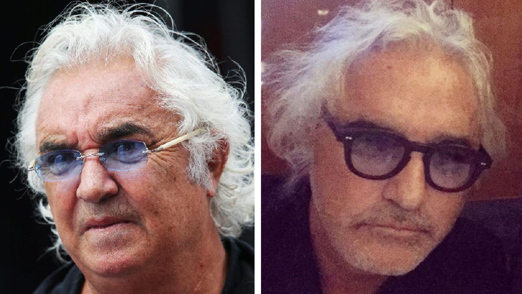 Flavio Briatore antes de operarse y después.