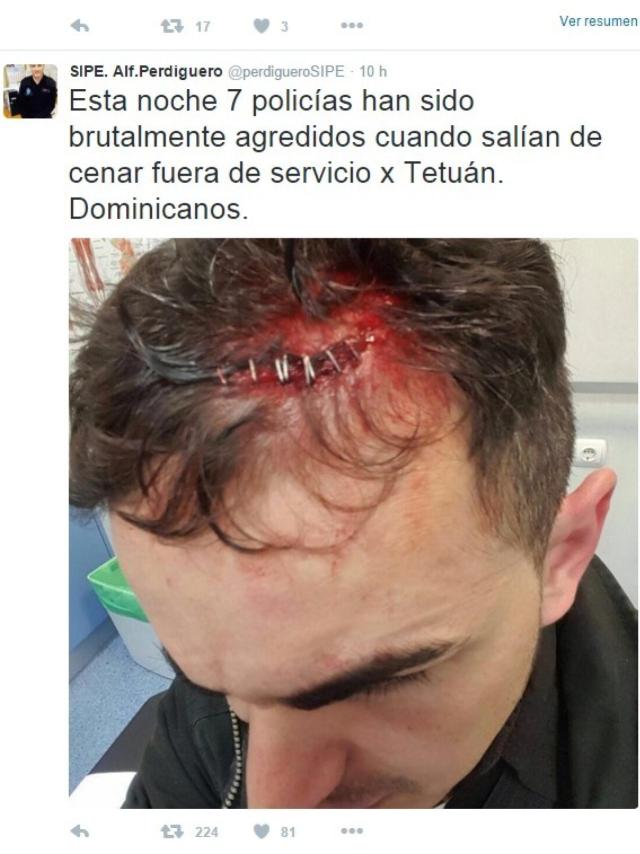 Uno de los policías agredidos
