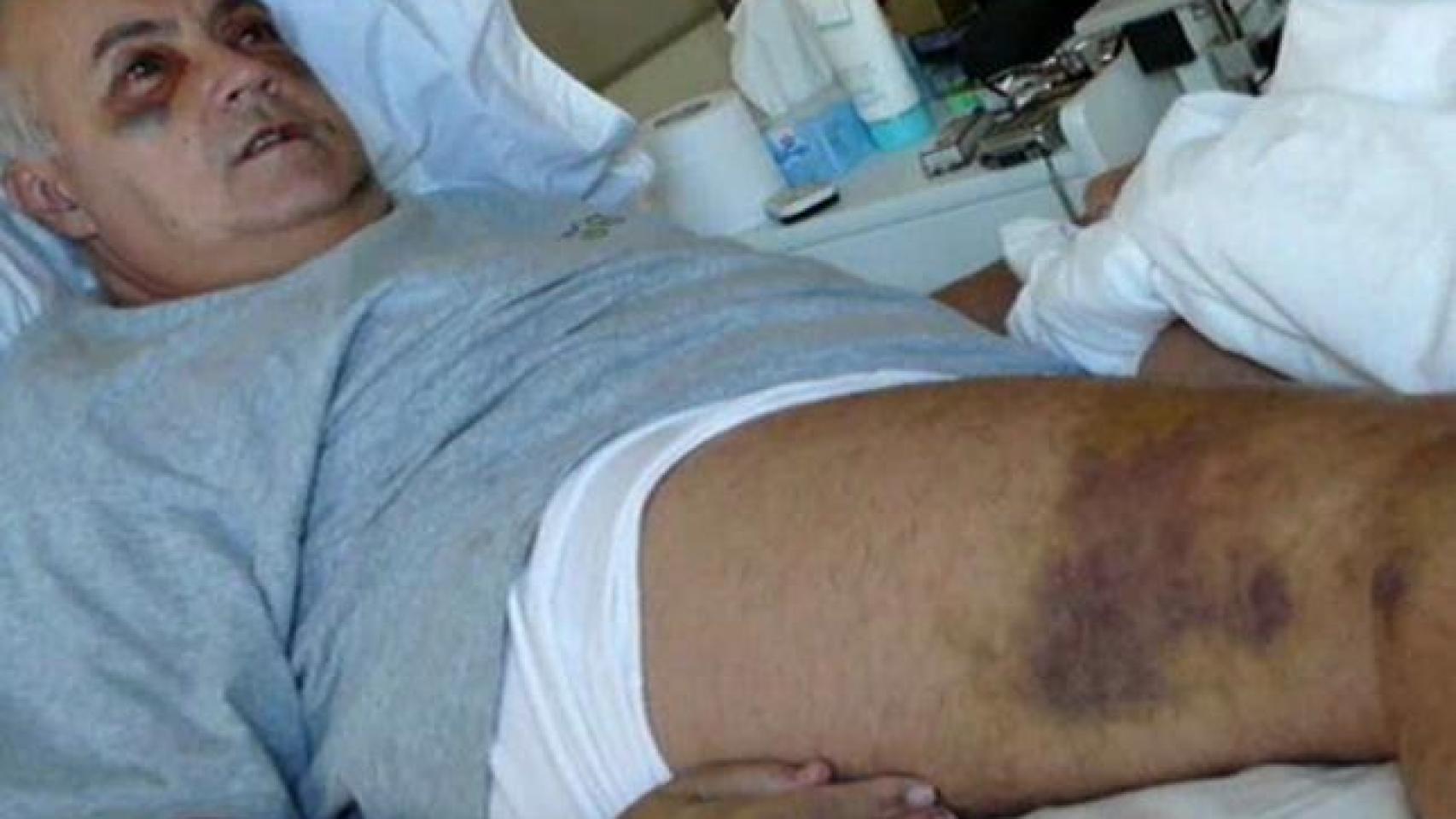 Moreno tuvo que ser hospitalizado varios días por la gravedad de las lesiones