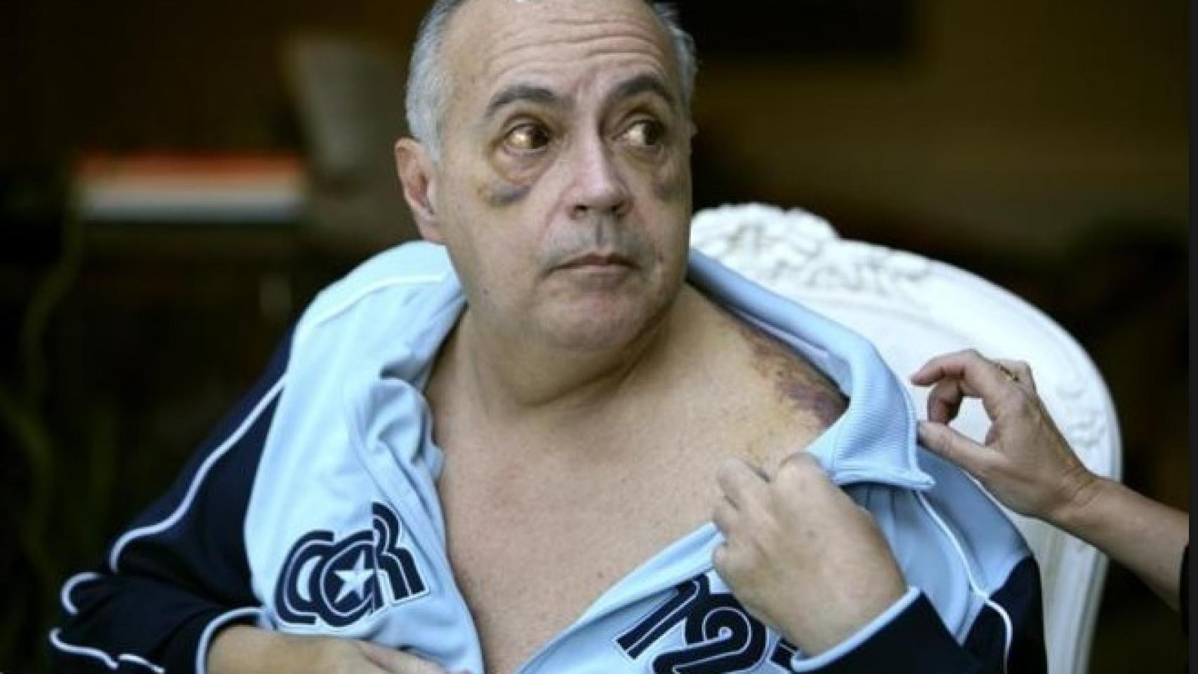 José Luis Moreno fue agredido brutalmente por unos atracadores en 2007