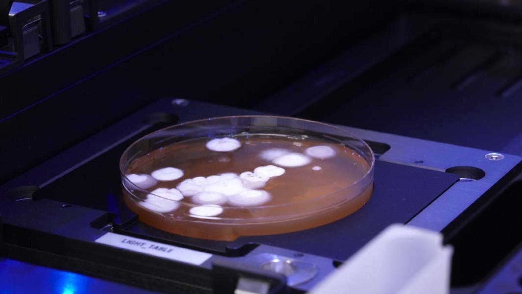 Uno de los cultivos de microorganismos en placa.