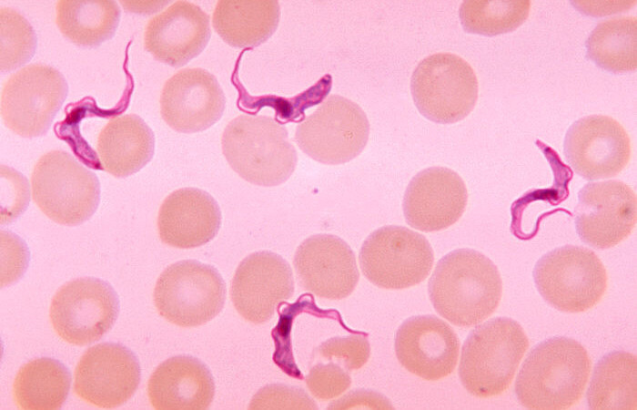 enfermedad del sueño