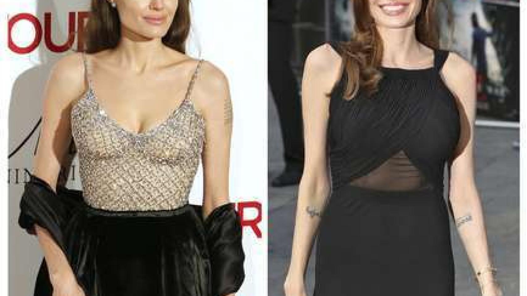 La actriz se sometió a una mastectomía por prevención