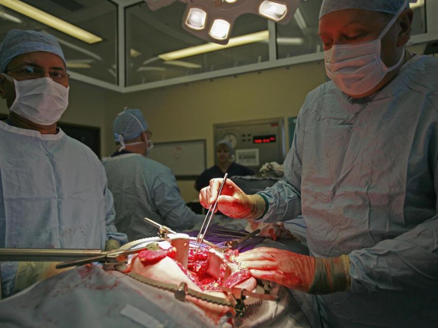 Dos cirujanos haciendo un trasplante de pulmón.