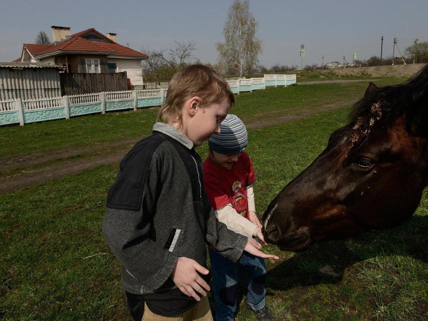 Stas nació con un tumor en el cerebro debido a la radiación.