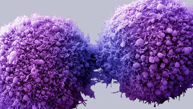 Metástasis de células cancerígenas.