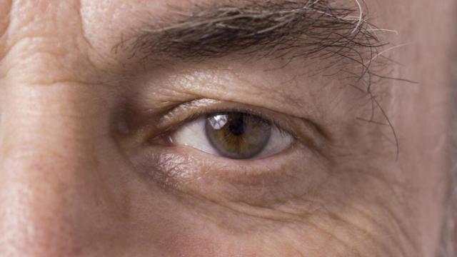 degeneración ocular