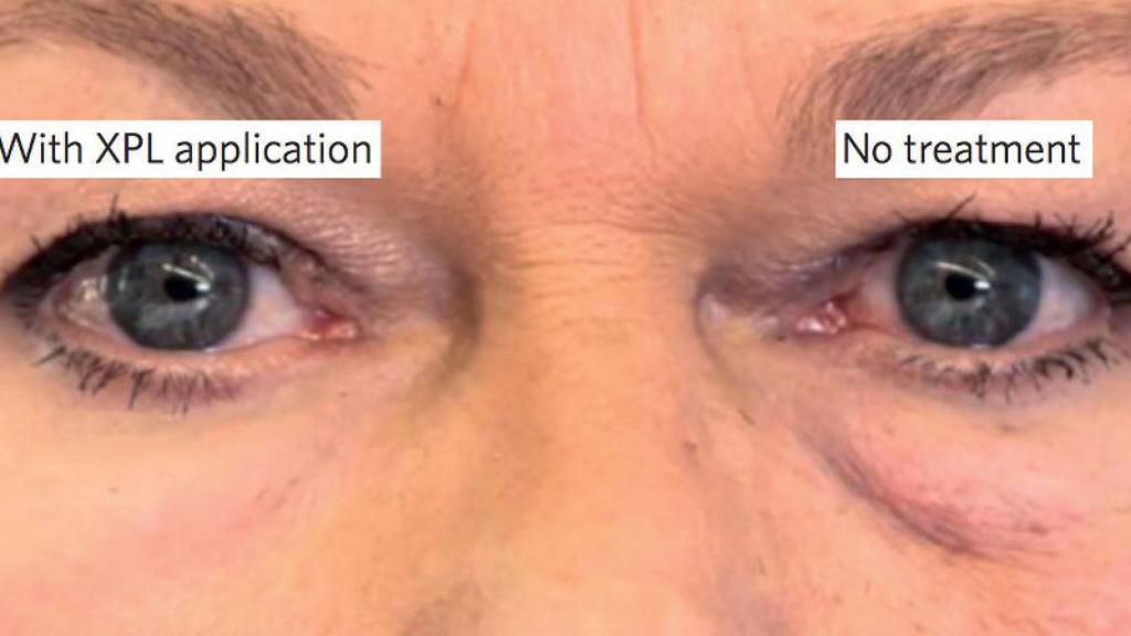 arrugas segunda piel 1