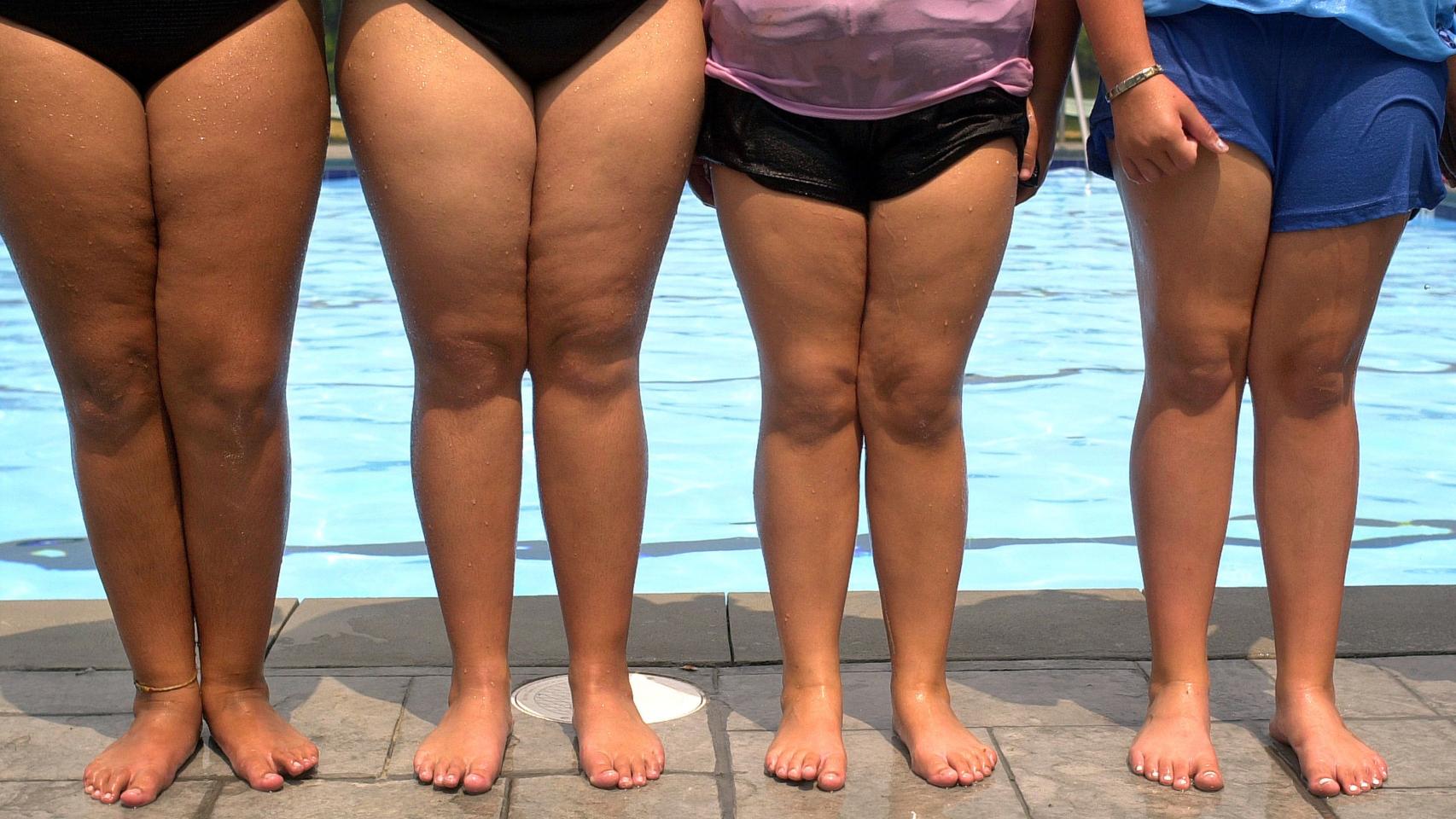 ¿Hay que cambiar la definición de sobrepeso?