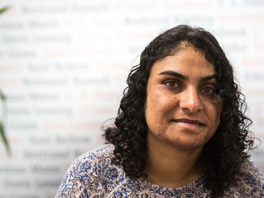 El rostro de Nadia Ghulam es una historia de superación y paz contra la guerra.