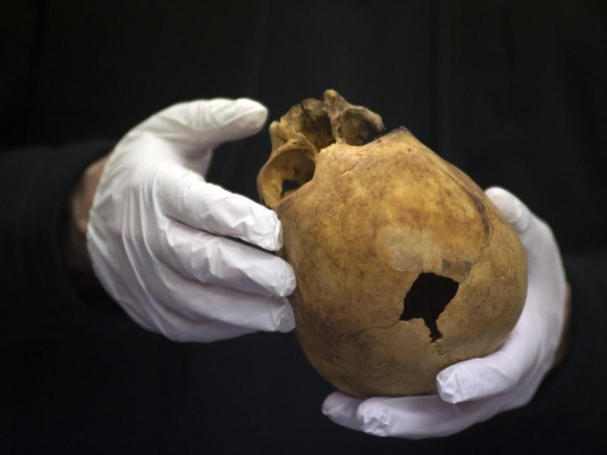 Ignasi Galtés, del Instituto de Medicina Legal de Cataluña, sostiene uno de los craneos infantiles.