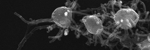 capsaspora_cellreportsslide