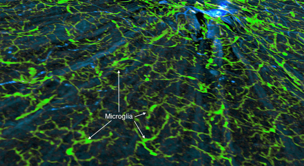 microglia